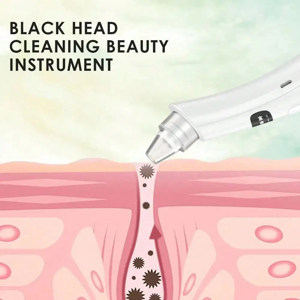3 Mode Vacuum Blackhead Remover Facial Cleansing Device
