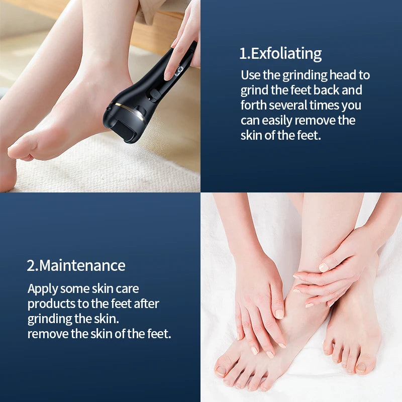 Rechargeable Electric Foot Grinder